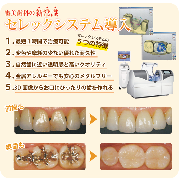 セレック 治療 と は